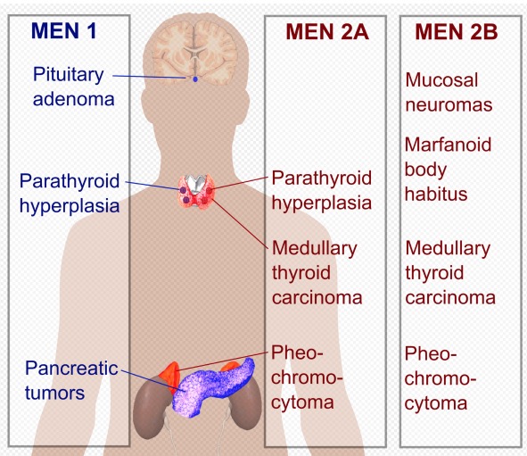 Mnohopočetná endokrinná neoplázia MEN1, MEN2A, MEN2B