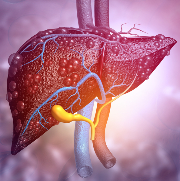 UDCA – bezpečná a účinná liečba pacientov s ochoreniami pečene